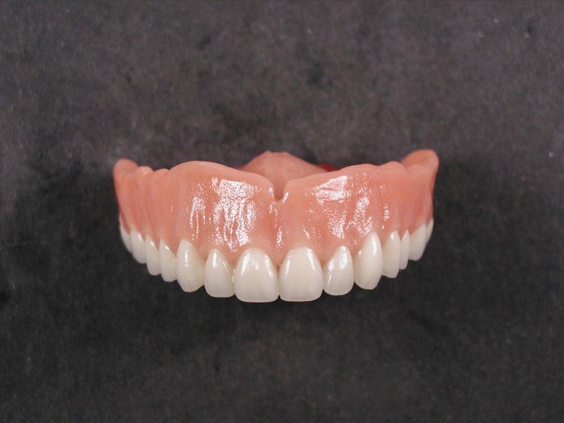 Immediate denture gymea denture clinic